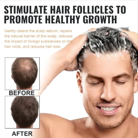 Anti-Hair Loss Repair Shampoo
